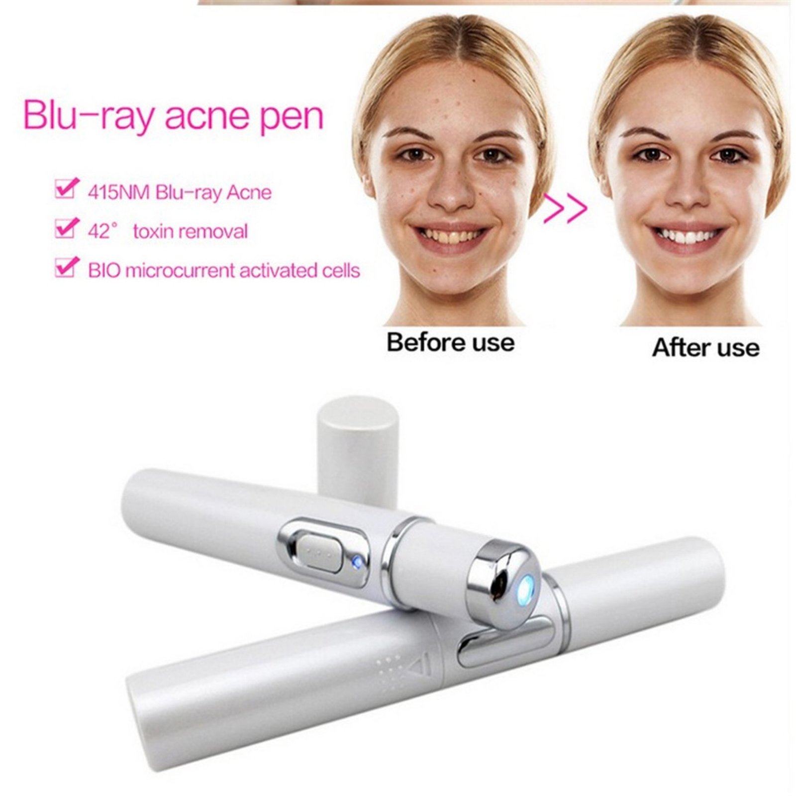 Blue Light Therapy Acne Laser Pen Soft Scar Wrinkle Removal Treatment Device Skin Care Beauty Equipment - Image 8