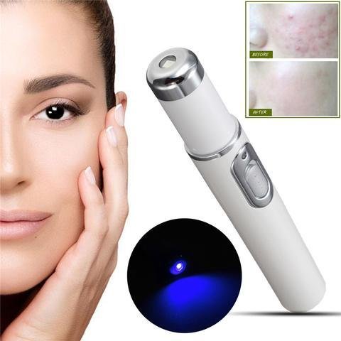 Blue Light Therapy Acne Laser Pen Soft Scar Wrinkle Removal Treatment Device Skin Care Beauty Equipment - Image 9